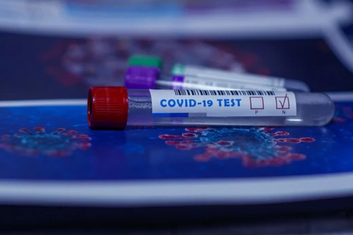 Firmy nevedia, ako budú testovať